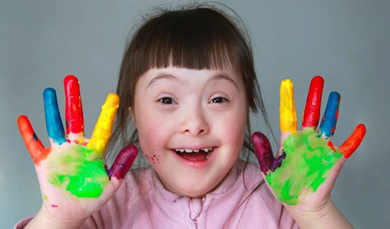 21 Mart Dünya Down Sendromu Farkındalık Günü