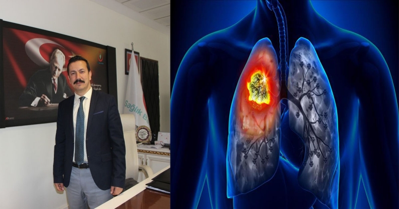Dr Nergiz; 'Akciğer kanseri ülkemizde ve dünyada erkeklerde en sık görülen kanser türüdür'